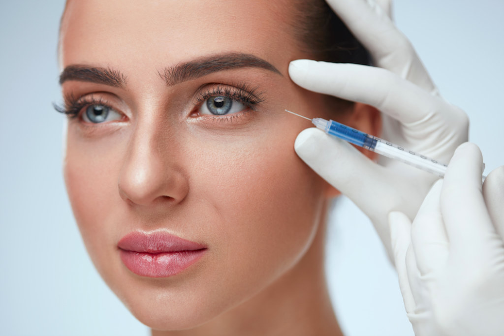 Výplně vrásek kyselinou hyaluronovou - ilustrační obrázek