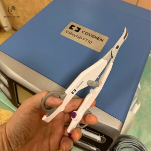 Das Instrument Ligasure Exact, dass zur Reduktion der Unterkieferspeicheldrüse verwendet wird